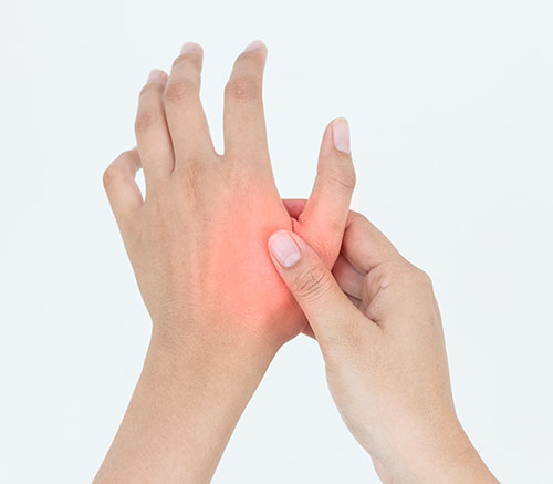 Rehabilitation for Base of Thumb (CMCJ) Arthritis